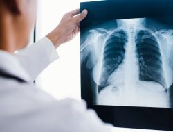 Rumah Tahanan Negara Marabahan Gelar Rontgen Massal